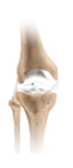 Knee Anterior Cruciate Ligament Injury
