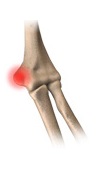 elbow rehabilitation protocols