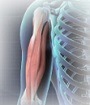 biceps tendon rupture