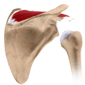 Shoulder Instability