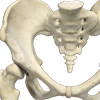 Hip Developmental Dysplasia