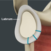 Labrum repair & reconstruction