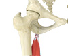 Proximal Hamstring Repair